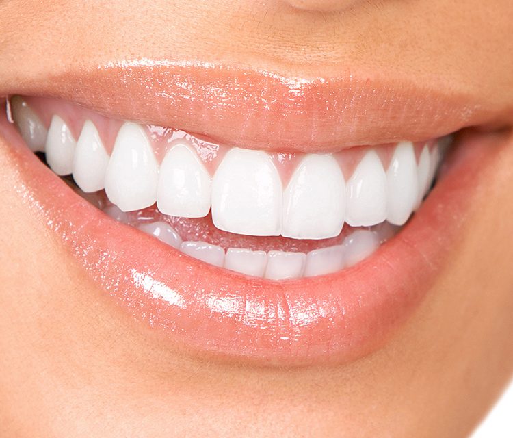 Beautiful smile after treatment at Gem Dental
